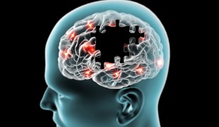 DNA Vaccine Protects Against Alzheimers