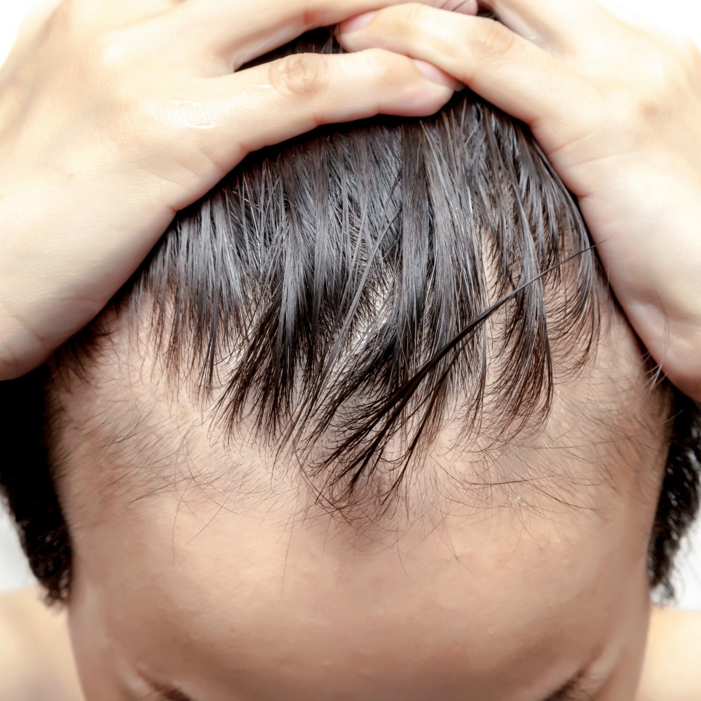 Hair Today, Gone Tomorrow!  Anti-Aging News