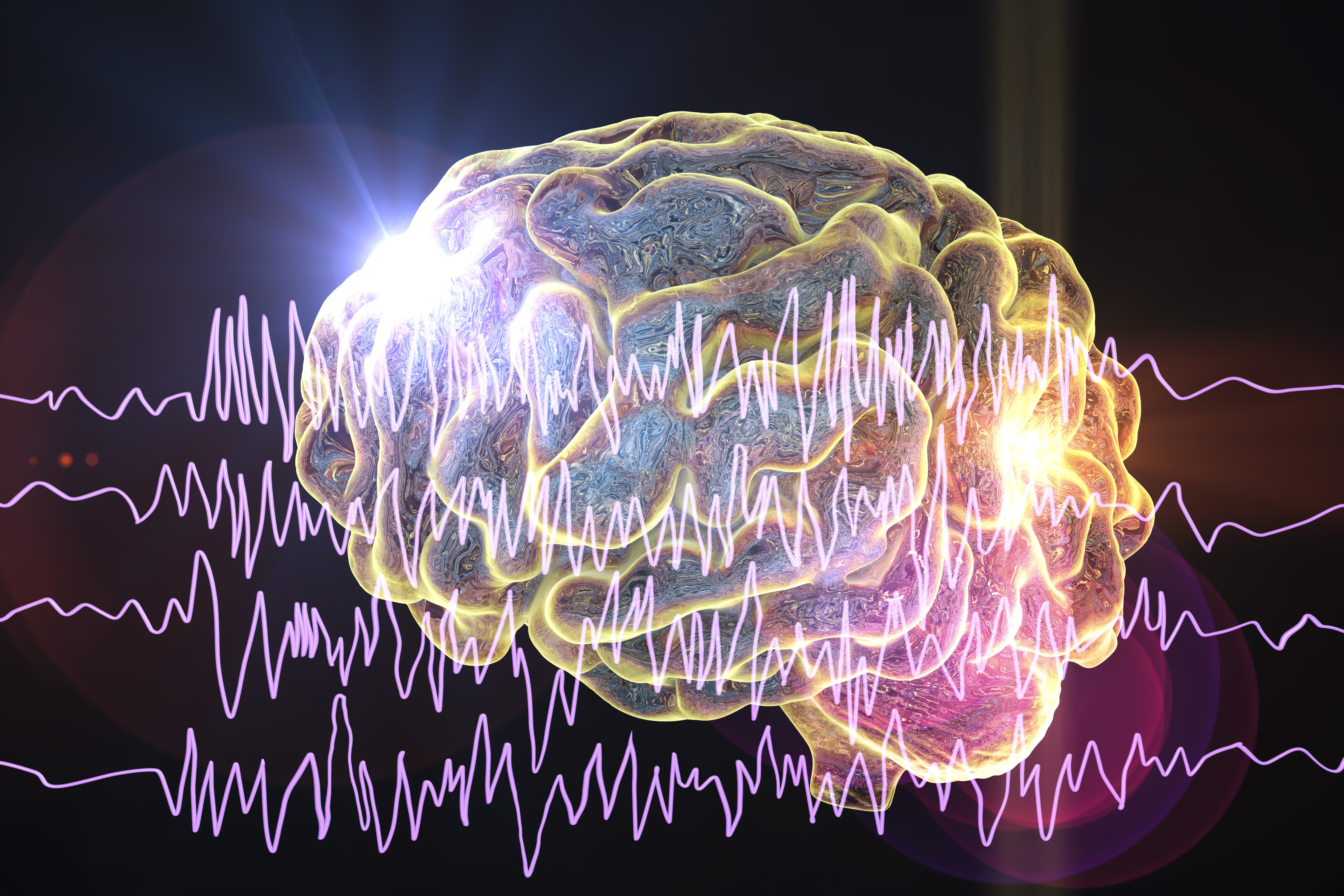 Время активного мозга. Эпилепсия мозг. Мозг эпилептика. Активность мозга. Электрическая активность мозга.